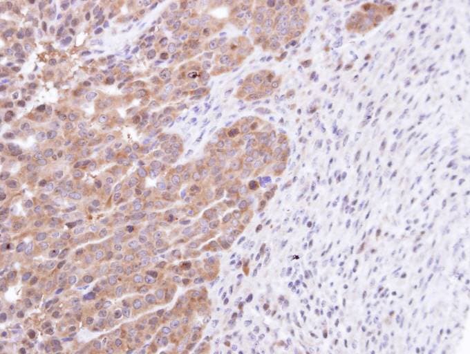 Polyclonal Rabbit anti-Human STK25 Antibody (aa1-231, IHC, WB)