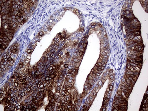 AGR2 Antibody (aa21-175, clone OTI3F2)