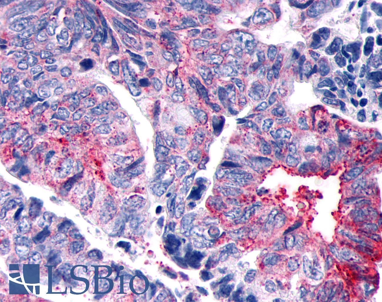 PathPlus™ Polyclonal Rabbit anti-Human GPER1 / GPR30 Antibody (Extracellular Domain, IHC, IF)