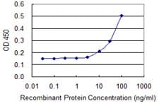 IHC-plus™ PPM1A / PP2CA Antibody (clone 4E11)