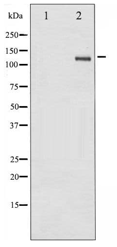 FAK / Focal Adhesion Kinase Antibody (phospho-Tyr861)