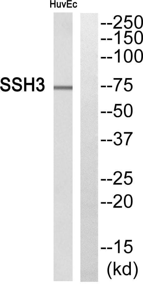 Polyclonal Rabbit anti-Human SSH3 Antibody (IHC, WB)