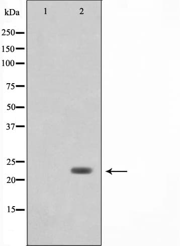 Polyclonal Rabbit anti-Human LDOC1L Antibody (IF, WB)