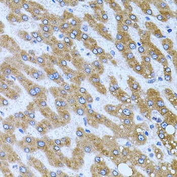 CPM / Carboxypeptidase M Antibody