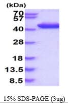 Human ALDOC / Aldolase C Protein (Recombinant His)