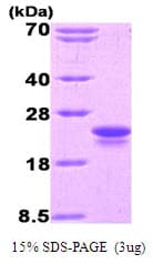 Mouse IL-1B / IL-1 Beta Protein (Recombinant His)