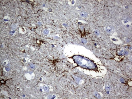 GFAP Antibody (clone UMAB129, Carrier-free)