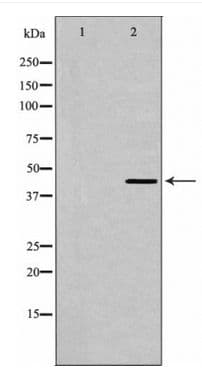Polyclonal Rabbit anti-Human HTR1A / 5-HT1A Receptor Antibody (WB)