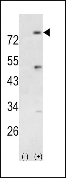 PIK3R5 Antibody (aa392-421)