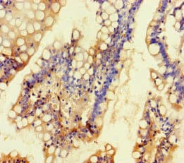 KCNK16 / TALK-1 Antibody