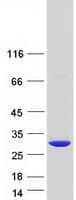 Human DNT / NT5C Protein (Recombinant Myc-DDK (Flag))