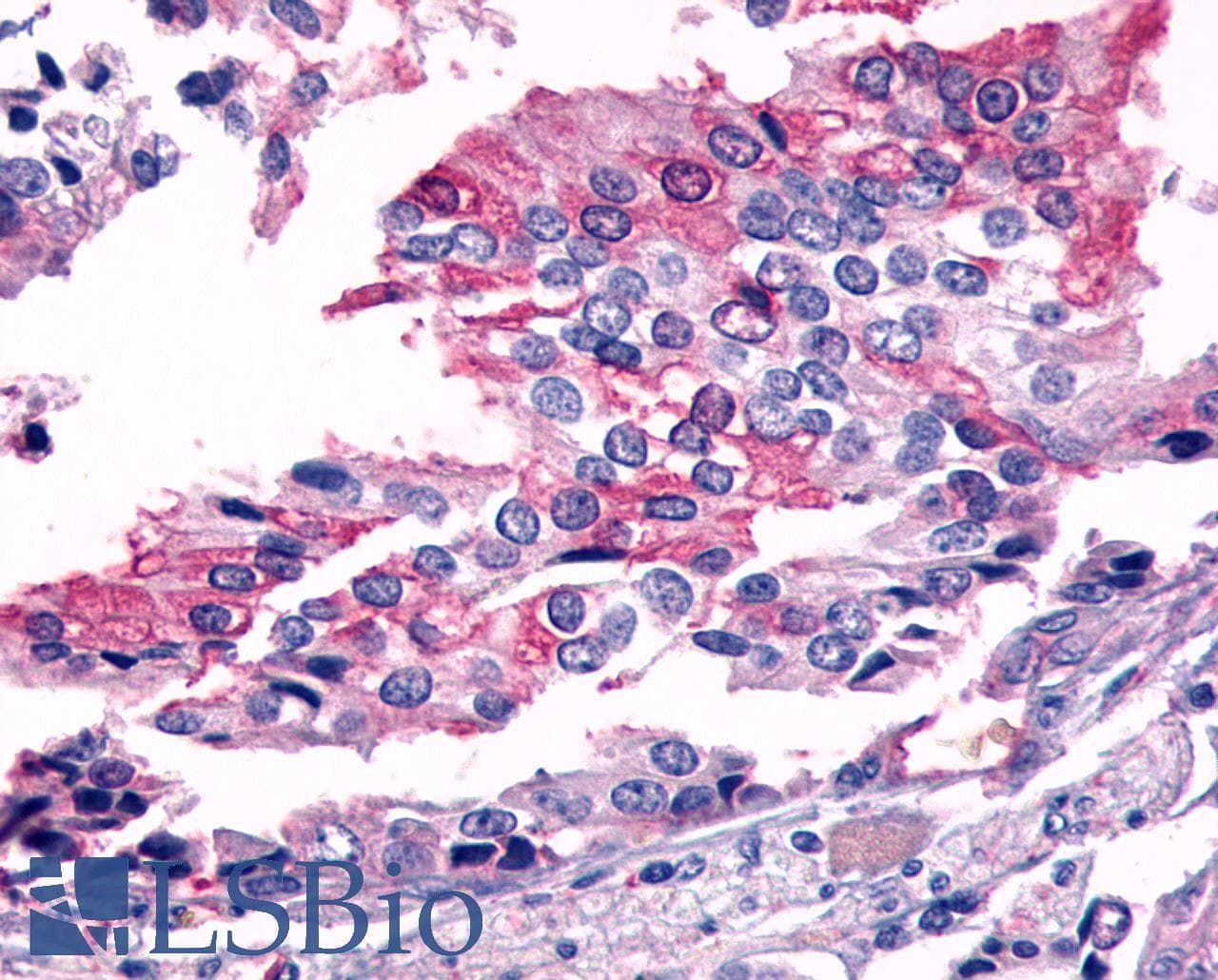 PathPlus™ Polyclonal Rabbit anti-Human FZD7 / Frizzled 7 Antibody (N-Terminus, IHC)