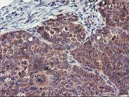 FGFR2 / FGF Receptor 2 Antibody (clone OTI5C5)