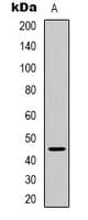 Polyclonal Rabbit anti-Human ARRDC2 Antibody (Internal, IHC, WB)