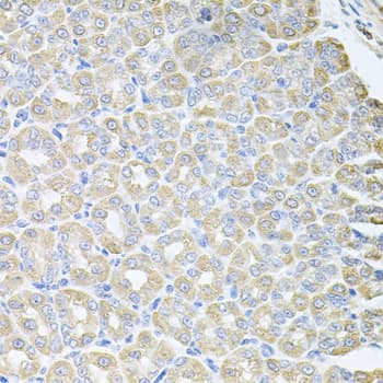 SKAP2 / SCAP2 Antibody