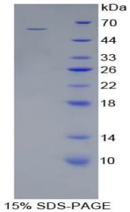 Pig CTSA / Cathepsin A Protein (Recombinant His-GST)