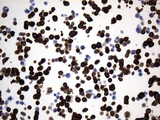Monoclonal Mouse anti-Human CD74 / CLIP Antibody (clone UMAB232, IHC, WB)