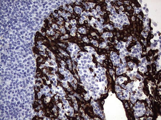KRT19 / CK19 / Cytokeratin 19 Antibody (aa240-390, clone OTI3D10)
