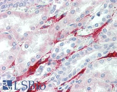 IHC-plus™ Polyclonal Rabbit anti-Human IDUA / MPS1 Antibody (aa28-653, IHC)
