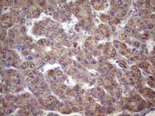FOXO4 / AFX1 Antibody (aa206-505, clone OTI1A4)