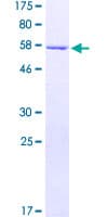 Human SNRNP35 Protein (Recombinant GST)