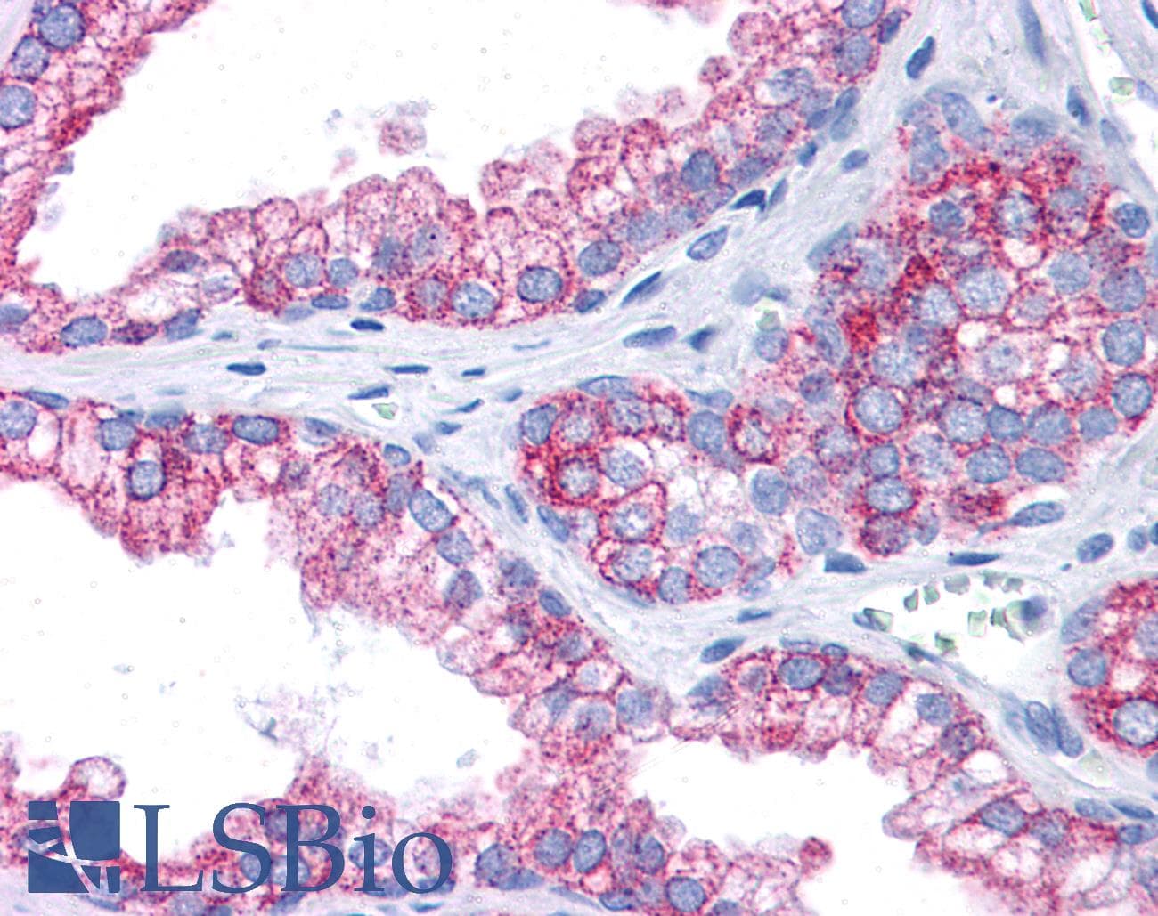 EPB41L2 Antibody (aa481-530)