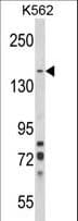 HSorCS / SORCS1 Antibody (aa126-154)