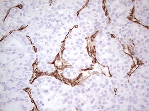 Monoclonal Mouse anti-Human DMN / Desmuslin / Synemin Antibody (clone 2F4, Carrier-free, aa329-580, IHC)