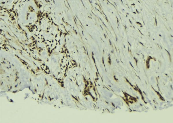 TAF12 Antibody