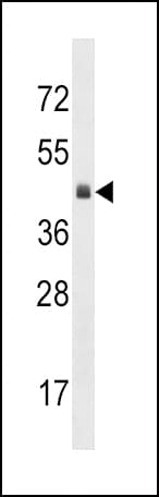 KLF12 Antibody (aa283-312)