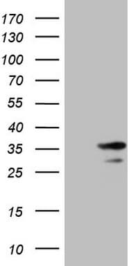 SNRPB2 Antibody (clone OTI2E8)