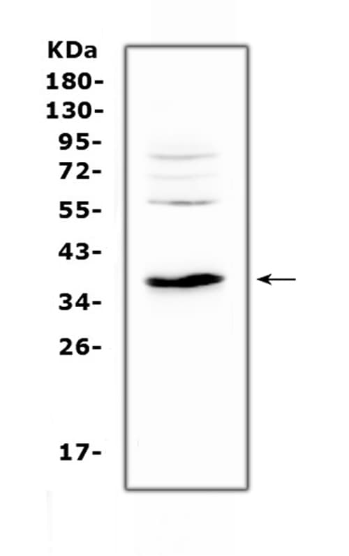 IL12B / IL12 p40 Antibody