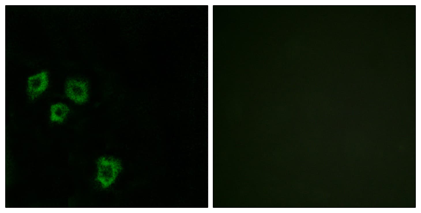 IHC-plus™ MUC16 / CA125 Antibody (aa13311-13360)