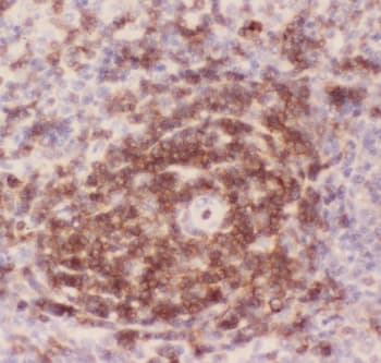 SPN / CD43 Antibody