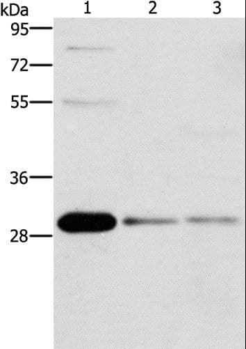 BCL10 / BCL-10 Antibody