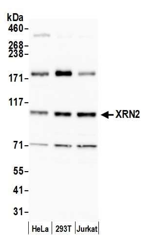 IHC-plus™ XRN2 Antibody (aa900-950)