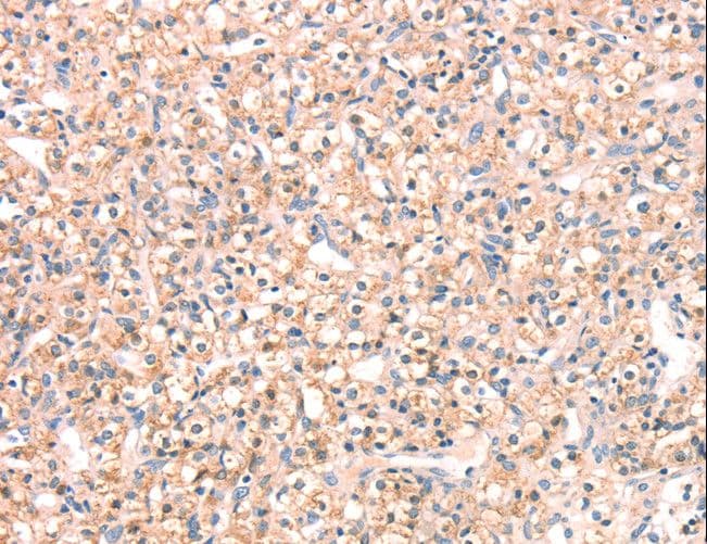 SNAP23 / SNAP-23 Antibody