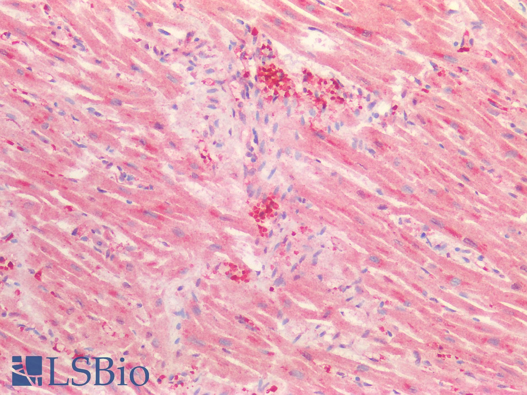 SEMA3C / Semaphorin 3C Antibody (aa292-396)