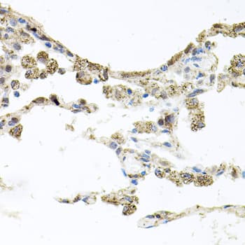 PIK3CB / PI3K Beta Antibody
