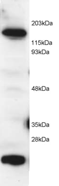 IHC-plus™ MS / MTR Antibody (aa1252-1265)