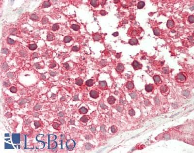 IHC-plus™ NF2 / Merlin Antibody (aa550-C-term)