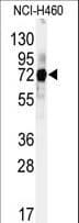Polyclonal Rabbit anti-Human CUL5 / Cullin-5 Antibody (aa747-774, IHC, WB)