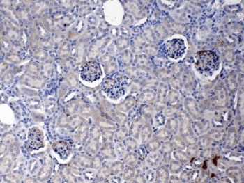 Polyclonal Rabbit anti-Mouse CRP / C-Reactive Protein Antibody (IHC, WB)