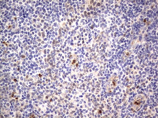 PRX-1 / PRRX1 Antibody (clone OTI1E10)