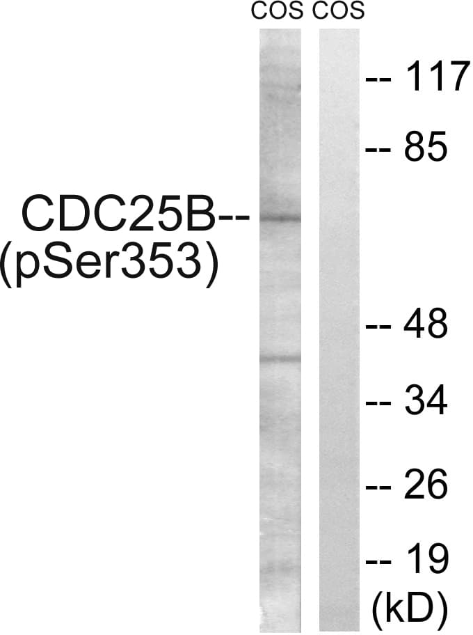 CDC25B Antibody (phospho-Ser353)