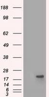 Monoclonal Mouse anti-Human CRYAB / Alpha B Crystallin Antibody (clone OTI4G5, IHC, WB)