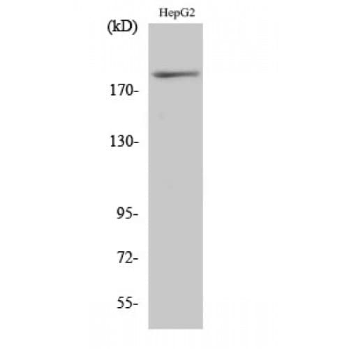 IRS1 Antibody (250-330 aa)