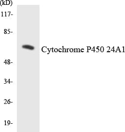 Polyclonal Rabbit anti-Human CYP24 / CYP24A1 Antibody (aa390-439, WB)