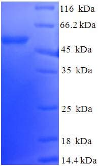 Human DNAJB2 Protein (Recombinant His-SUMO)