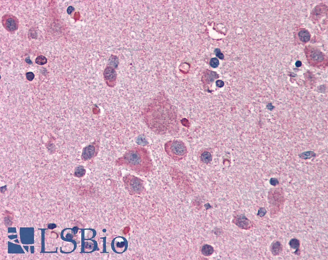 IHC-plus™ Monoclonal Mouse anti-Human NDN / Necdin Antibody (clone 1B3, IHC, IF, WB)